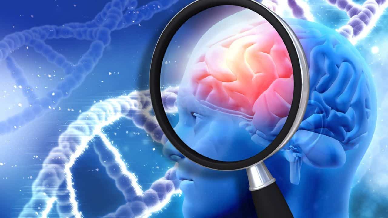 Alzheimer farmaco cura 